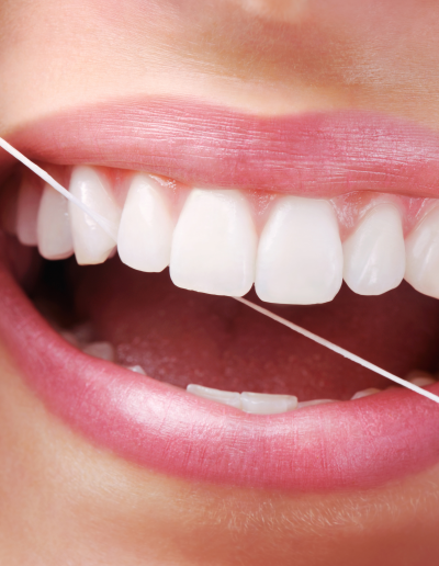 Dental-flosi